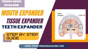 Mouth Expander
